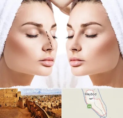 عمل بینی در میبد
