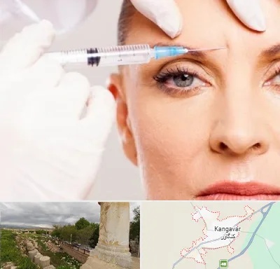 مزوژل در کنگاور