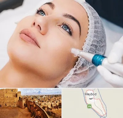مزونیدلینگ در میبد