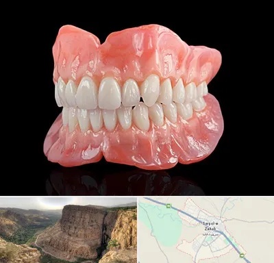 ساخت دندان مصنوعی در سرپل ذهاب