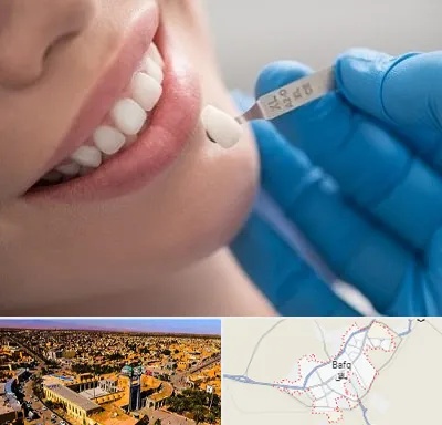 مرکز لمینت دندان در بافق