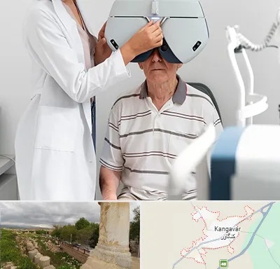 دکتر سرطان چشم در کنگاور