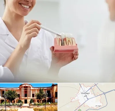 دکتر دندانساز در خمین