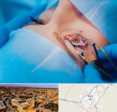 عمل prk چشم در بافق