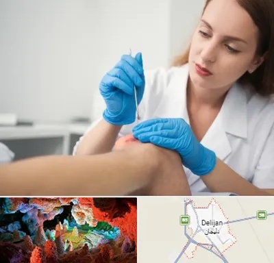 متخصص زخم در دلیجان