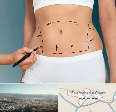 دکتر طب سنتی برای لاغری در اسلام آباد غرب