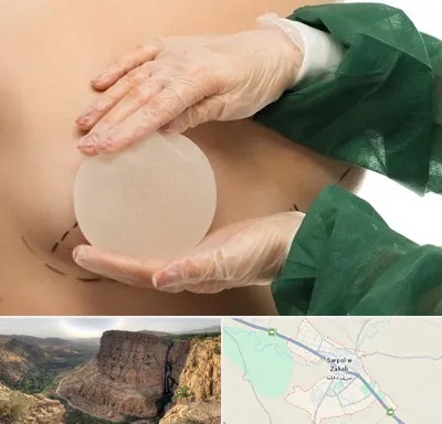 جراحی پروتز سینه در سرپل ذهاب