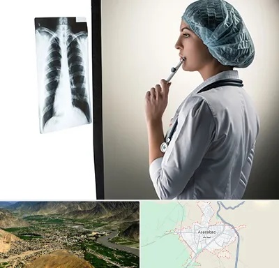 دکتر سرطان ریه در اسدآباد