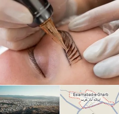 میکروبلیدینگ در اسلام آباد غرب