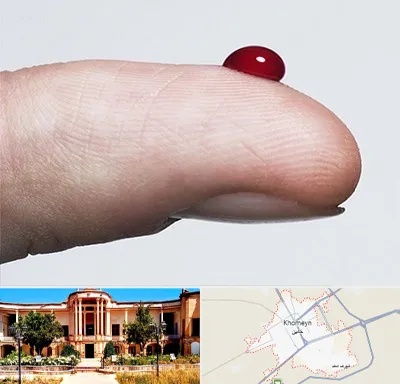 مرکز فصد خون در خمین