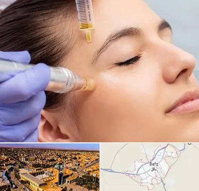 میکرونیدلینگ در بافق