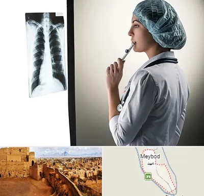 دکتر سرطان ریه در میبد