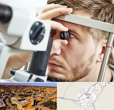فوق تخصص قرنیه در بافق