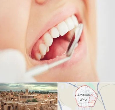 اصلاح طرح لبخند در اردکان
