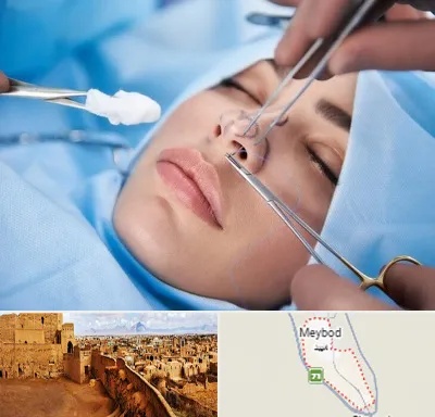 عمل ترمیمی بینی در میبد