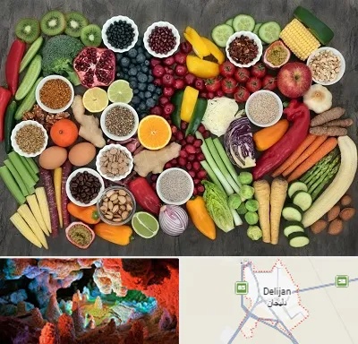 دکتر تغذیه برای چاقی در دلیجان