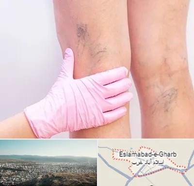 دکتر فوق تخصص واریس در اسلام آباد غرب