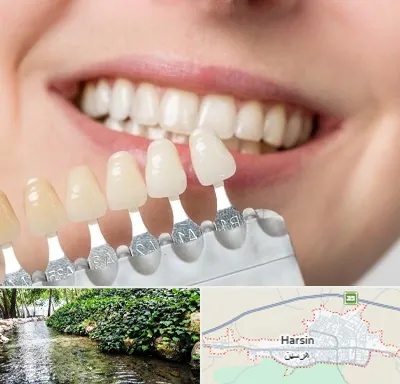 مرکز کامپوزیت دندان در هرسین