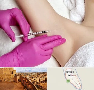 تزریق بوتاکس زیر بغل در میبد