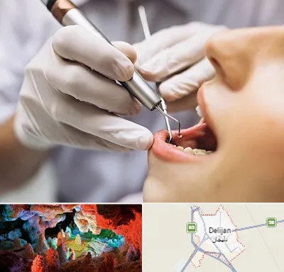 دندانپزشکی ارزان در دلیجان
