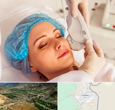اکسنت در اسدآباد