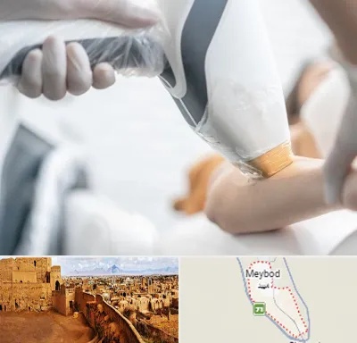 تجهیزات پزشکی زیبایی در میبد
