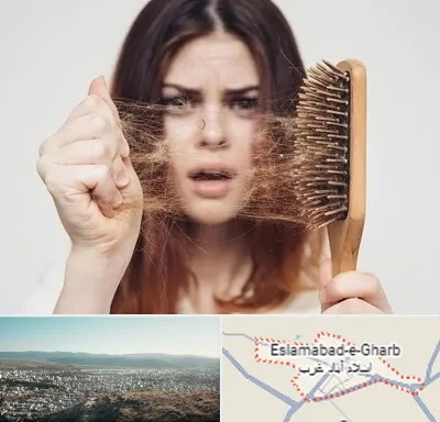 دکتر ریزش مو در اسلام آباد غرب