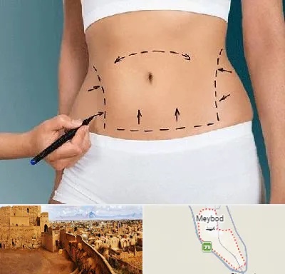 دکتر طب سنتی برای لاغری در میبد