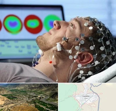 مرکز نوار مغز در اسدآباد
