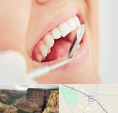 اصلاح طرح لبخند در سرپل ذهاب