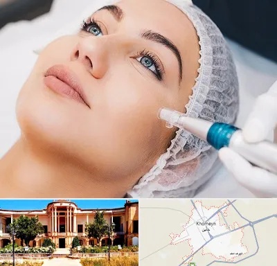 مزونیدلینگ در خمین