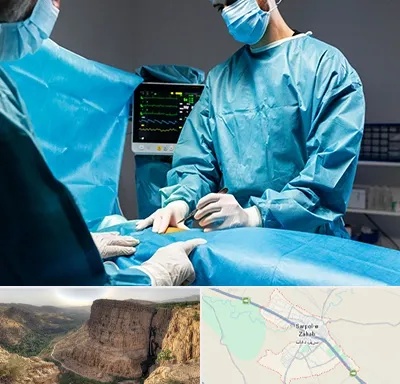 جراح سرطان کلیه در سرپل ذهاب