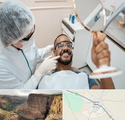 ایمپلنت فوری در سرپل ذهاب