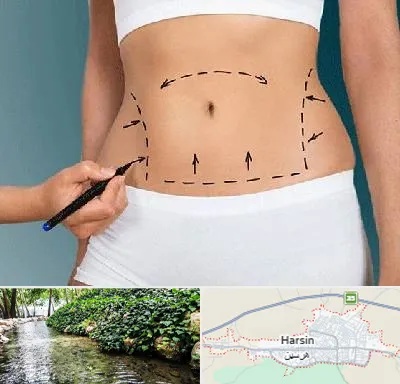دکتر طب سنتی برای لاغری در هرسین