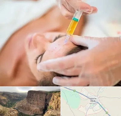 پی آر پی در سرپل ذهاب