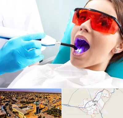 جراحی لثه با لیزر در بافق
