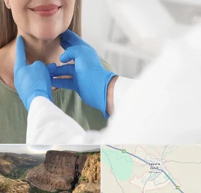 جراح سرطان گلو در سرپل ذهاب