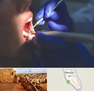 عصب کشی در میبد