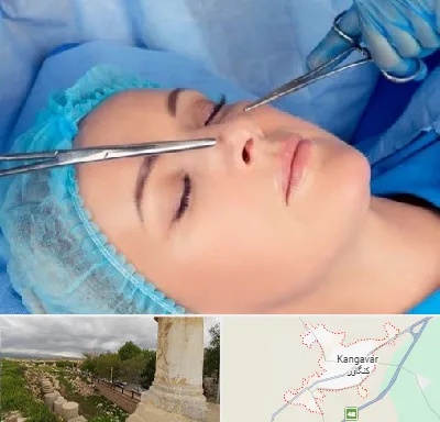 عمل بینی نیمه فانتزی در کنگاور
