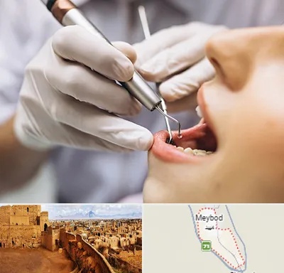 دندانپزشکی ارزان در میبد