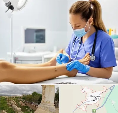 کارشناس زخم در کنگاور