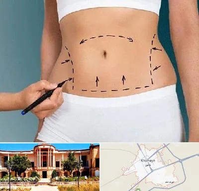دکتر طب سنتی برای لاغری در خمین
