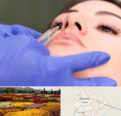 هیالاز در محلات