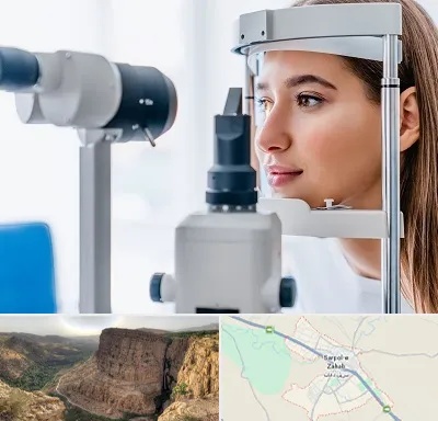 فوق تخصص شبکیه در سرپل ذهاب