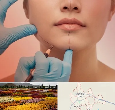 دکتر زیبایی خانم در محلات