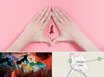 دکتر سرطان واژن در دلیجان