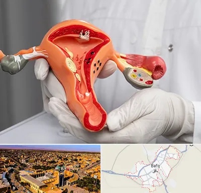 دکتر سرطان رحم در بافق