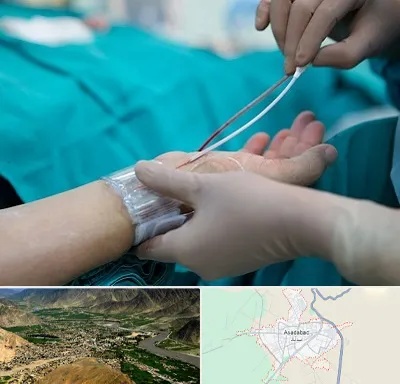 آنژیوگرافی در اسدآباد