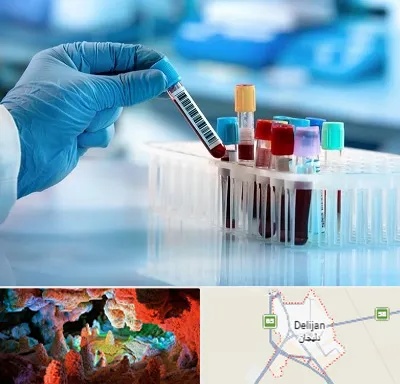 آزمایشگاه خون قبل از ازدواج در دلیجان