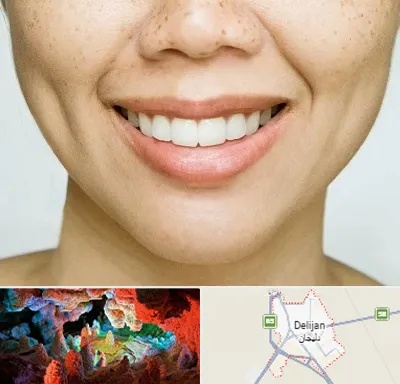 عمل چال گونه در دلیجان